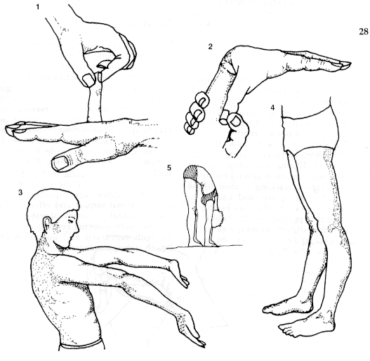 Beighton scale.gif