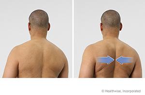 296032067_shoulderblades.jpg.d5a6647a7eed3b3c8725bfaf4631176b.jpg